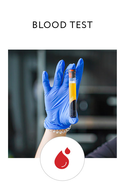 10X Health Blood Test